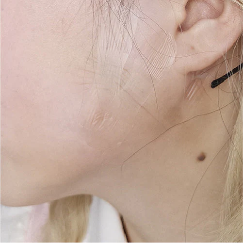 Face Lifting Tape - Image 5
